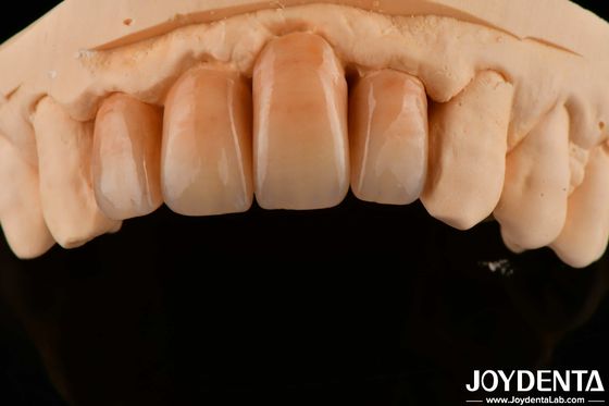 Buy Polished Layered Zirconia White And Durable For Perfect Surface Finish online manufacture