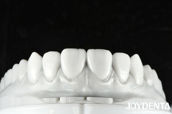 Buy Natural Color Dental Wax Up Versatile Solution for Single or Multiple Teeth Restoration online manufacture