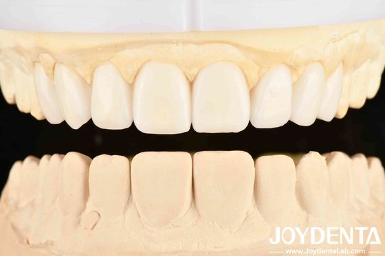 Buy Dental's Good Elasticity And Tooth Arrangement Technology Flexible Denture Finish In Dental Care online manufacture