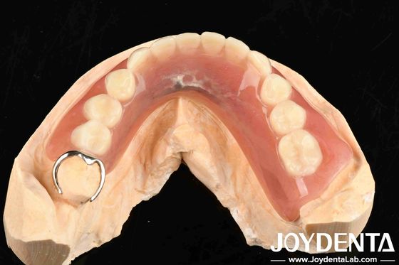Buy Metals And Resins Framework Set Up Teeth Finish for Stable Oral Structure in Dental Configuration online manufacture