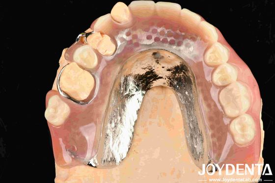 Buy Beautiful And Harmonious Framework Set UP Teeth Finish for Dental Treatment Rooms online manufacture