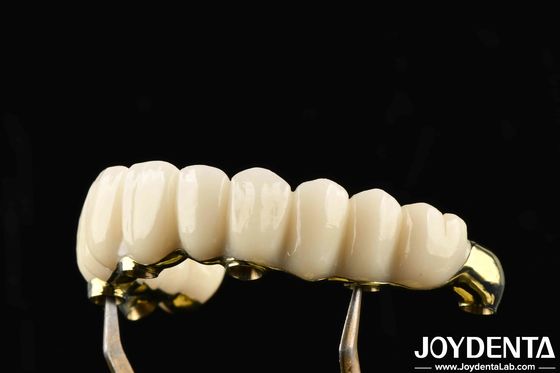 Buy Comfortable To Wear Ti-Bar Zirconia Hybrid Bridge Restores Chewing Function Compatible With Natural Teeth And Gums online manufacture