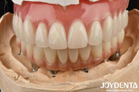 Buy Good Elasticity Dental with Tooth Arrangement Technology online manufacture