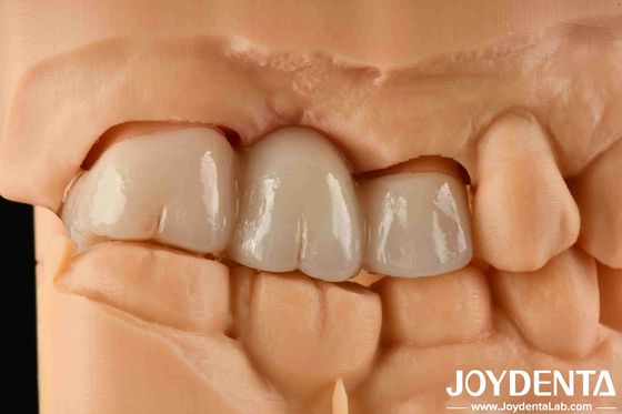 Buy Experience Color Realistic Full Zirconia With High Resistance To Staining And Flexural Strength Of 1000 MPa online manufacture