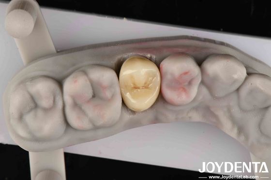 Buy Fracture Toughness 9 MPa·m1/2 High Aesthetics High Resistance To Wear Full Zirconia online manufacture