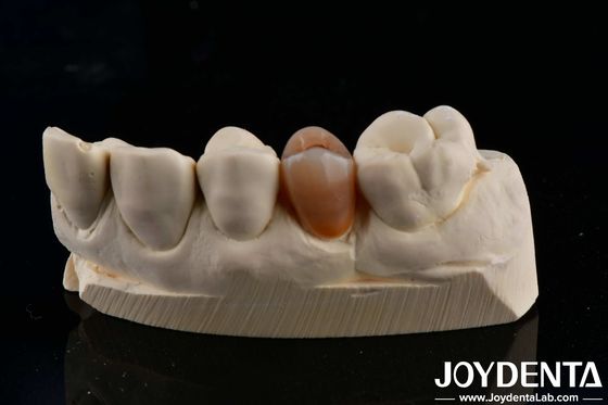 Buy Biocompatible And Natural-looking Multilayer Full Zirconia With Esthetics online manufacture