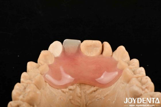 Buy High Stealth Good Elasticity Flexible Denture Finish For Diverse Manufacturing Processes online manufacture