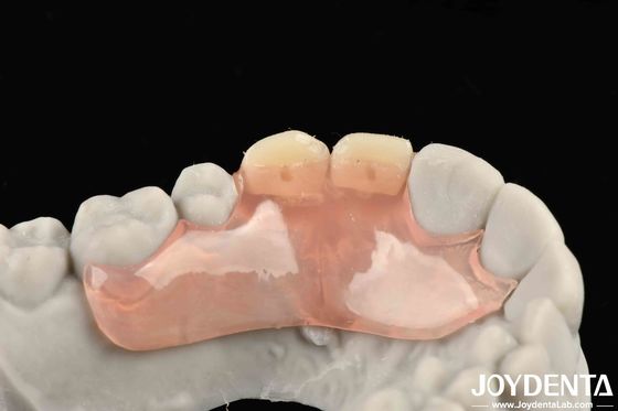 Buy Beautiful And Harmonious Appearance Design Framework Set Up Teeth Finish Elaborate Technology For Stable Oral Structure online manufacture