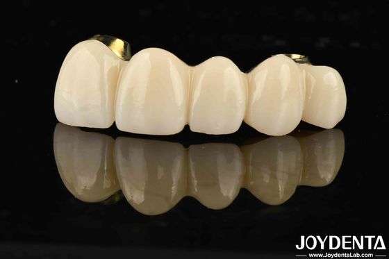 Buy Excellent Strength Ti-Bar Zirconia Hybrid Bridge For Natural Teeth And Gums Compatibility online manufacture