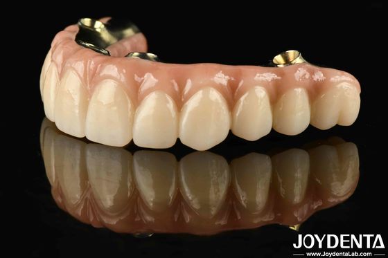 Buy Custom-made Ti-Bar Zirconia Hybrid Bridge Resistant To Corrosion And Wear Restoring Chewing Function With Precision online manufacture