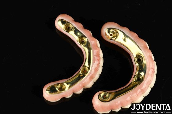 Buy Natural-looking Aesthetics Zirconia Hybrid Bridge With High Durability And Biocompatibility Ti-Bar Zirconia Hybrid Bridge online manufacture
