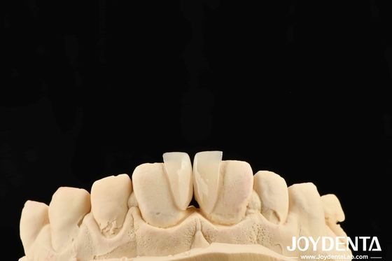 Buy High Durability Micro Veneer 0.2mm Thickness And Dependable Performance online manufacture