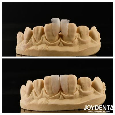 Buy Easy To Install Micro Veneer Ultimate Solution For Interior Decoration Thickness 0.2mm online manufacture