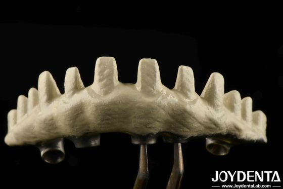 Buy Internal Hex Connection Type Custom Implant Abutments Sandblasted And Acid-etched For Superior Fit online manufacture