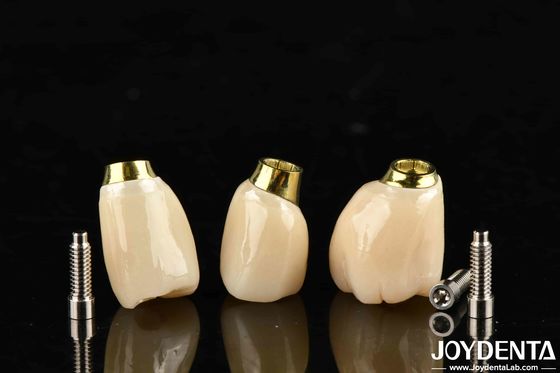 Buy High Durability White Finish Implant Crown And Bridge With Accurate Fit online manufacture