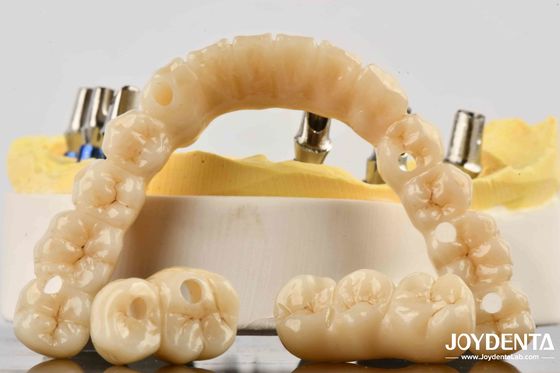 Buy Unmatched Accuracy Zirconia Implant Bridge Commitment To Comfort online manufacture