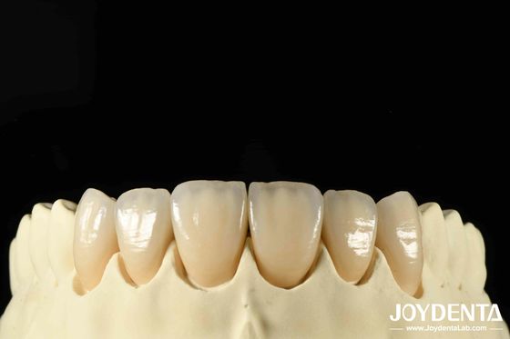 Buy Bionic Development Leaves And Distinct Layers Of Zirconia All-Ceramic online manufacture