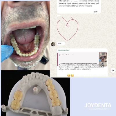 Buy Zirconia dentures that imitate natural teeth online manufacture