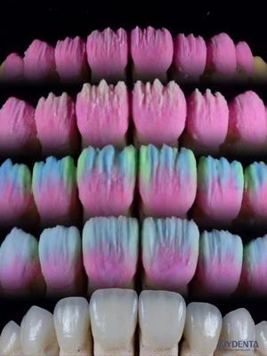 Buy The Joydenta Ceramic Veneer Process online manufacture