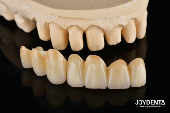 Buy Unveil True Biomimicry: Introducing Our Multi-Layered Zirconia Aesthetic Bridge online manufacture