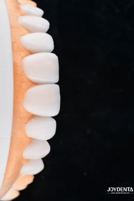 Buy Enhance Case Acceptance & Patient Communication with Our Diagnostic Wax-Up Service online manufacture