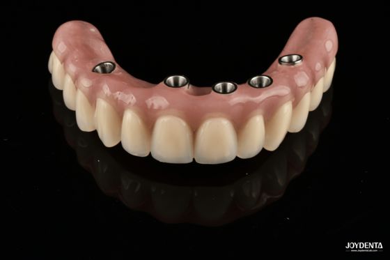 Buy Redefining Full Arch Prosthetics: Unmatched Fit and Function with Our Ti-Base Complete Dentures online manufacture