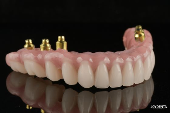 Buy The Strength of Titanium, The Art of Natural Aesthetics. online manufacture