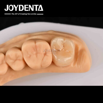 Buy High Strength Emax Inlay Onlay A2 Color Long Lasting For Damaged Teeth Restoration online manufacture