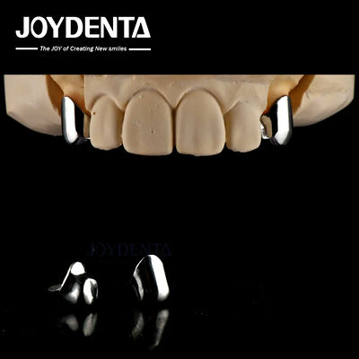 Buy Precision Removable Prosthesis Dental Implant Attachments Easy Clean Comfortable Fit online manufacture