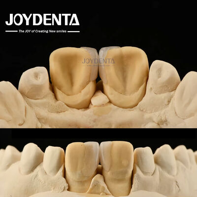 Buy 0.2mm Thickness Microthin Veneers Glass Ceramic Dental Veneers For Front Teeth online manufacture