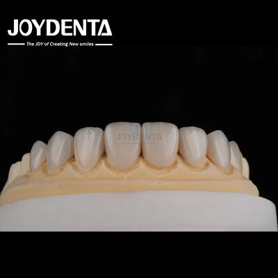Buy Real Looking Glass Ceramic Teeth Veneers With Glossy Or Matte Surface Finish online manufacture