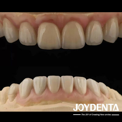 Buy High Translucency Emax Cosmetic Dentistry Veneers High Aesthetics Ultra Thin online manufacture