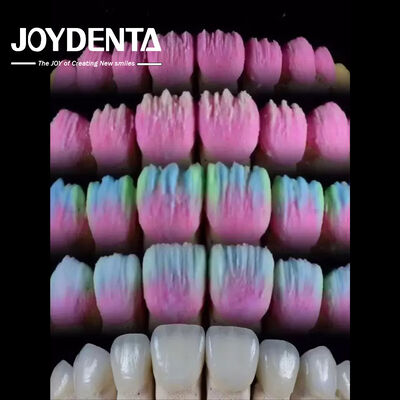 Buy The Joydenta Ceramic Veneer Process online manufacture