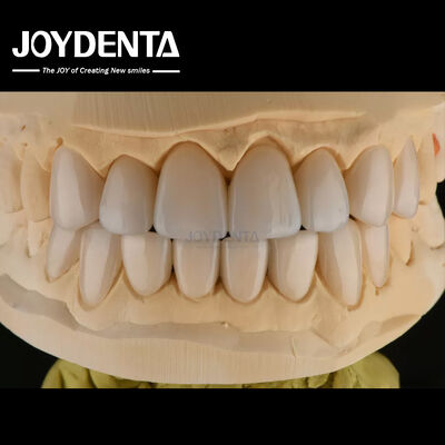 Buy 0.3-0.5mm Thick Feldspathic Porcelain Veneer High Fracture Resistance Upgrade Your Smile online manufacture