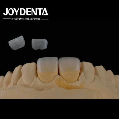 Buy Long Lasting Dental Feldspathic Veneer Natural Tooth Color Translucent Appearance online manufacture