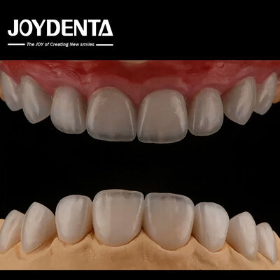 Buy High Translucency Feldspathic Veneer , Cosmetic Porcelain Veneers With Strong Adhesion online manufacture