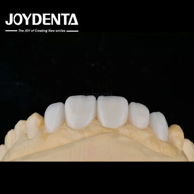 Buy Customization Porcelain Material Emax Teeth Veneers For High Aesthetics Bonding online manufacture