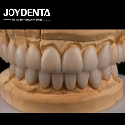 Buy 0.3mm Thickness Ips Emax Veneers Ceramic Veneers Anterior Posterior Restorations online manufacture