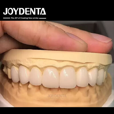 Buy 16 Shades Color Emax Dental Veneers A1-A4 High Stain Resistance For Perfectly Smiles online manufacture