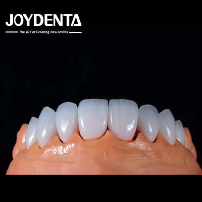 Buy A1-A4 Ips Emax Press Porcelain Dental Veneers Stain Resistant Customizable Shape online manufacture