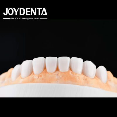 Buy Enhance Case Acceptance & Patient Communication with Our Diagnostic Wax-Up Service online manufacture