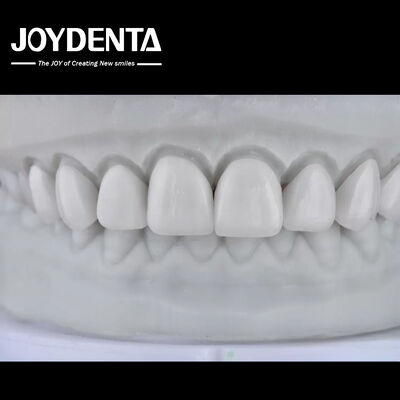 Buy Visualize the Result, Secure the Case: Our Diagnostic Wax-Up Service online manufacture