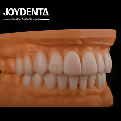 Buy Smooth Replicated Diagnostic Wax Up FDA , Full Arch Teeth Wax Up Highly Accurate online manufacture