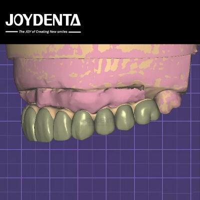 Buy HIPAA Compliant Data Security Digital Wax Up 3D Model For Dental Modifications online manufacture