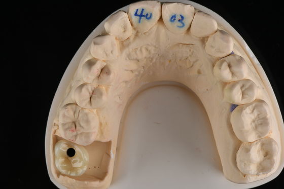 Professional Grade Dental Zirconia Hybrid Imitation Material Smooth Or Rough Surface