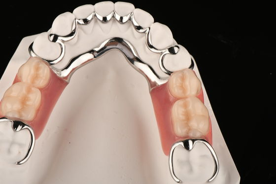 Stain Resistant Acrylic Partial Denture For Natural Comfort Replacing Missing Teeth