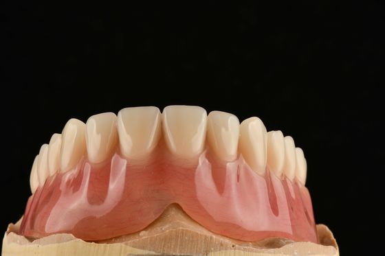 Comfortable Clear Adjustable Removable Partial Denture That Resemble Natural Teeth