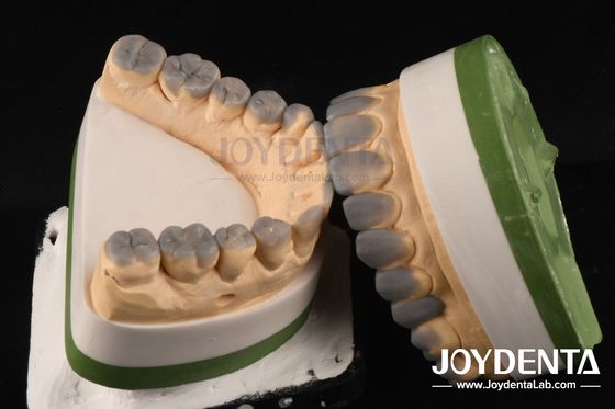 Highly Accurate Temporary Dental Diagnostic Wax Up Customized 1-2mm Thickness