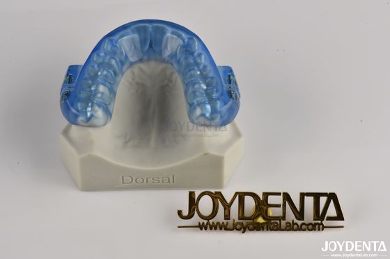 Custom Fitted Adjustable Anti Snoring Mouthpiece / Snore Mouthguard All Night Comfort