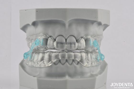 Silicone Anti Snoring Mouthpiece Stop Snoring Dental Appliance Comfortable